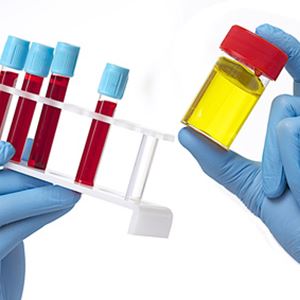 Laboratorio Analisi